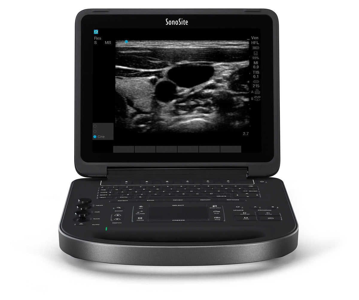 About Ultrasounds: Sonosite Edge II