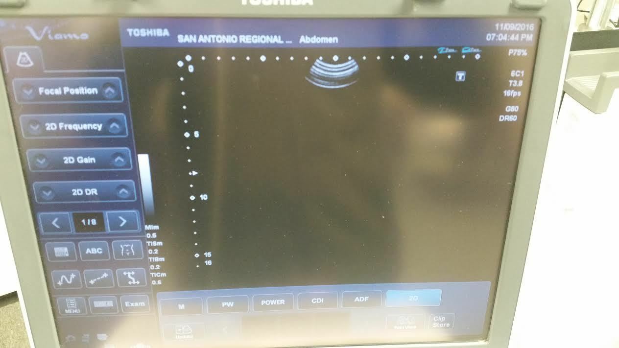 Toshiba Viamo Ultrasound Machine