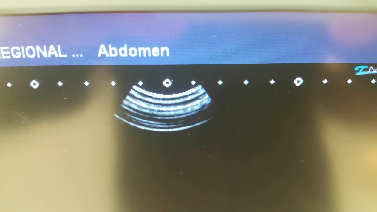 Toshiba Viamo Ultrasound Machine