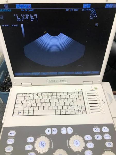Siemens Acuson  P300 Portable Ultrasound Machine