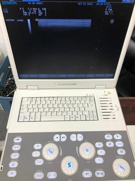 Siemens Acuson  P300 Portable Ultrasound Machine