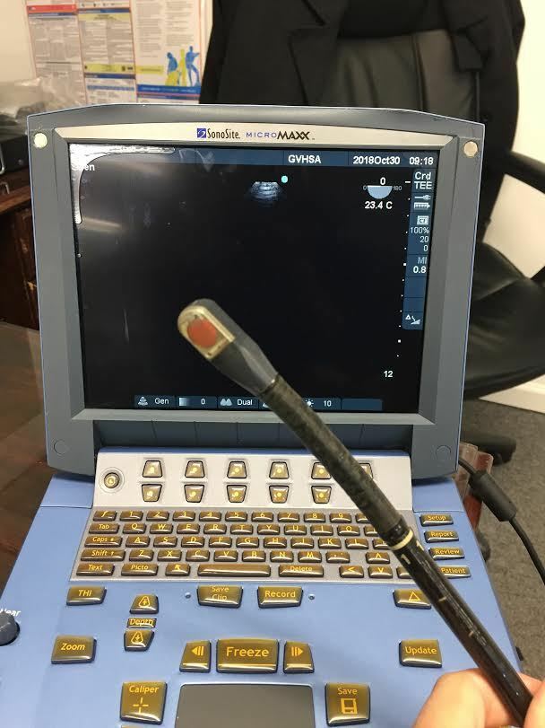 Sonosite TEE 8-3 MHz. Probe Transducer