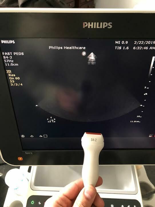 Philips S4-2 Sector Array Phased Array Cardiac Probe Transducer for Sparq