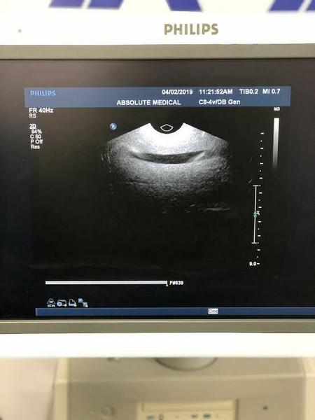 Philips  C8-4V Endocavitary Probe