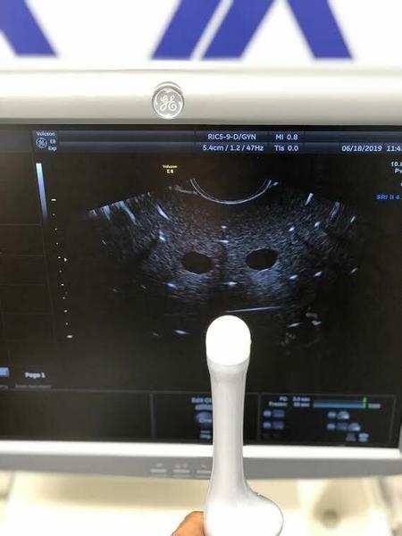 GE RIC5-9-D Endocavitary Probe