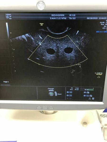 GE RIC5-9-D Endocavitary Probe