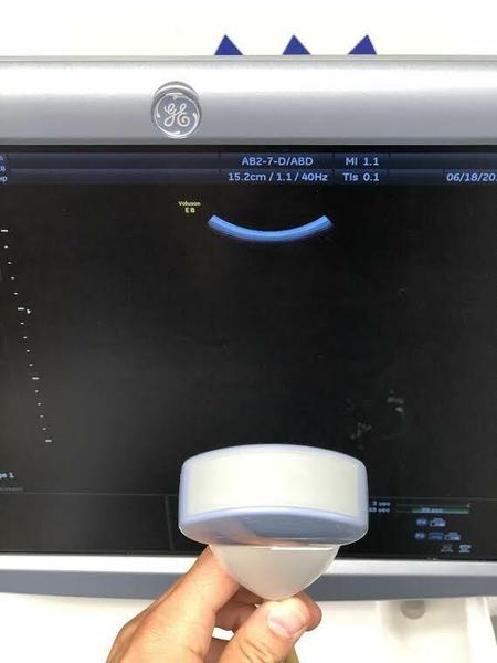 GE AB2-7-D Curved Array Probe