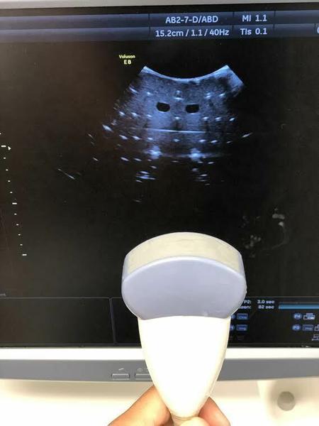 GE AB2-7-D Curved Array Probe