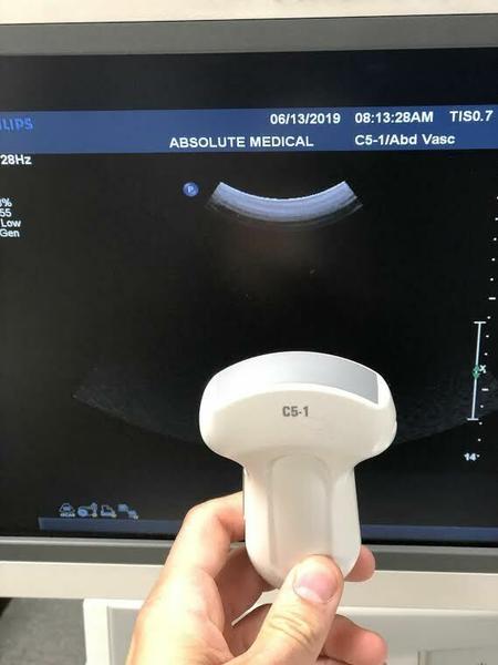 Philips C5-1 Curved Array Probe