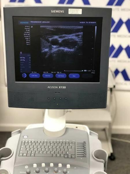 Siemens Acuson X150 Ultrasound System