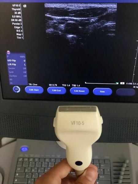 Siemens Acuson VF10-5 Linear Array Probe