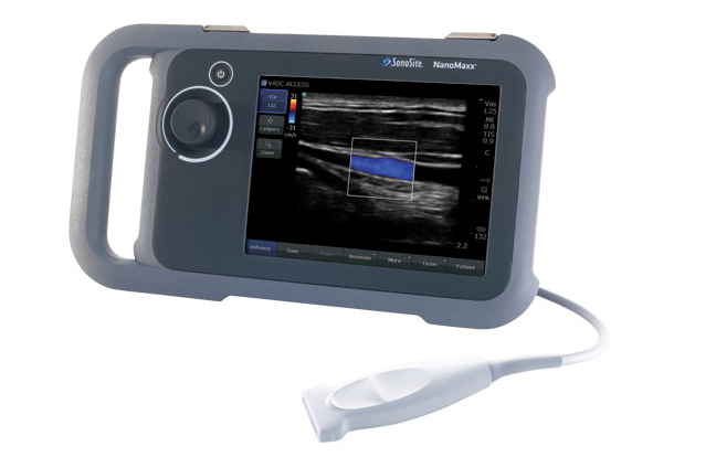 Sonosite Nanomaxx Portable Ultrasound System – AME Sonosite Nanomaxx Portable Ultrasound System – AME