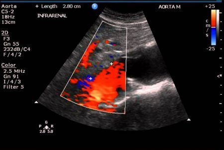 How It Works: Abdominal Ultrasound Probes and Transducers