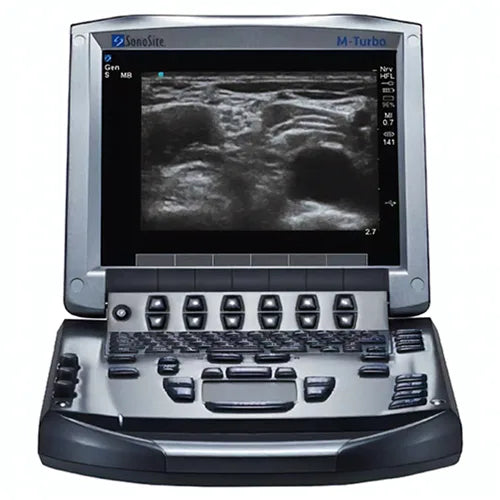 About Ultrasounds: Sonosite M-Turbo