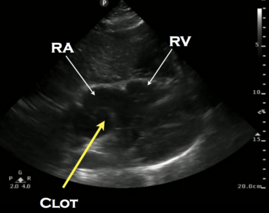 How It Works: Cardiac Ultrasound Probes and Transducers