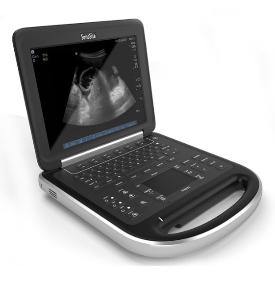 Understand Sonosite Portable Ultrasounds: Part II