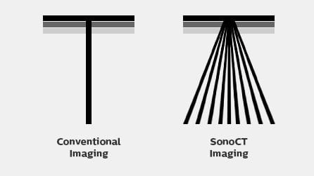 Ultrasounds Made Easy Part IV: Compound Imaging