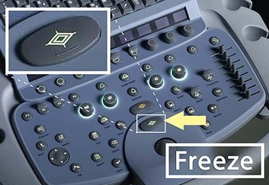 Ultrasounds Made Easy I: Freeze Button
