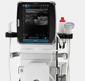 Economic Ultrasounds: GE Venue 50