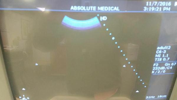 Philips C6-3 Curved Array Probe