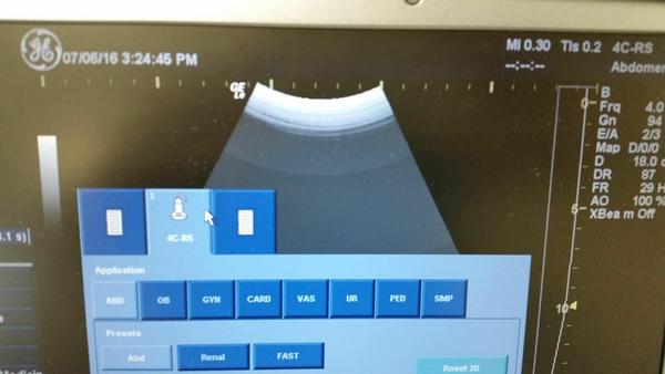 GE 4C-RS Curved Array Ultrasound Probe