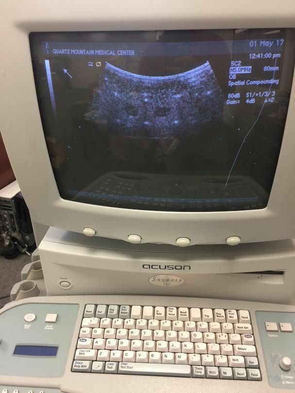 Acuson 5C2 Abdominal Ultrasound Probe