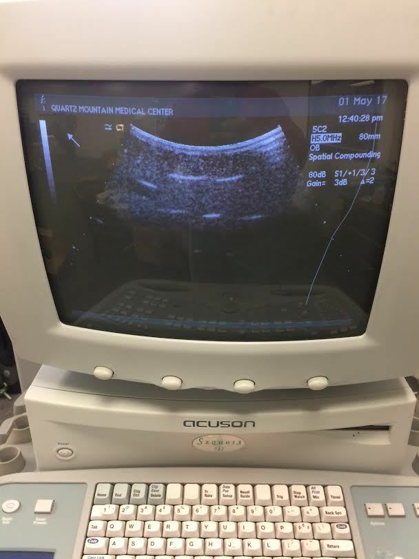 Acuson 5C2 Abdominal Ultrasound Probe