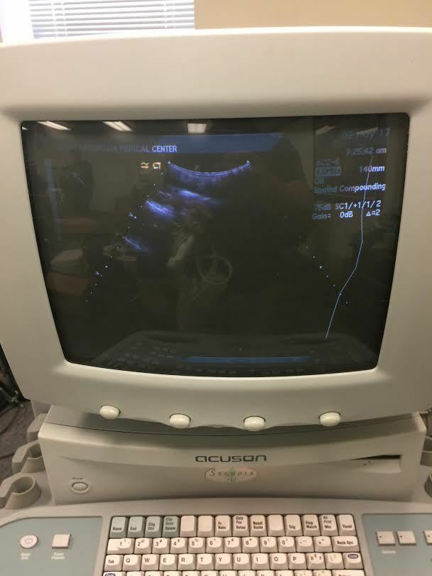 Acuson 6C2 Ultrasound Probe Transducer