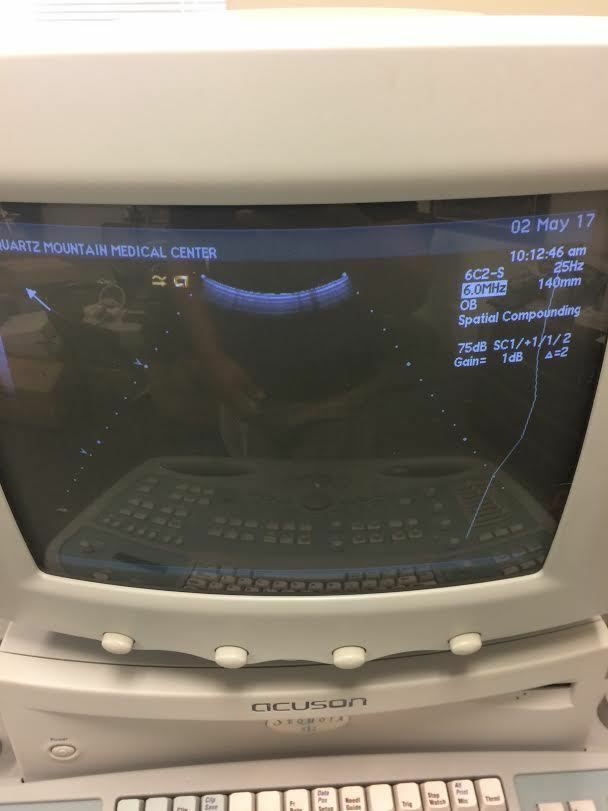 Acuson 6C2 Ultrasound Probe Transducer