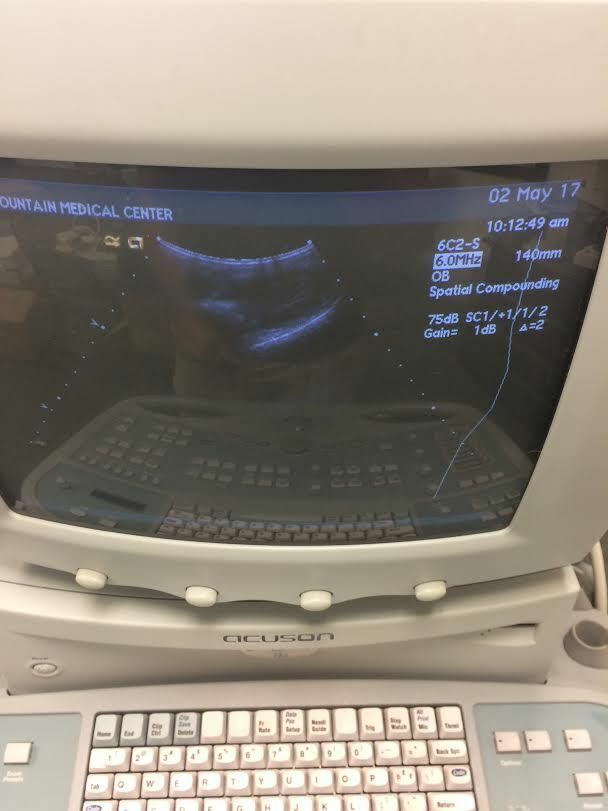 Acuson 6C2 Ultrasound Probe Transducer
