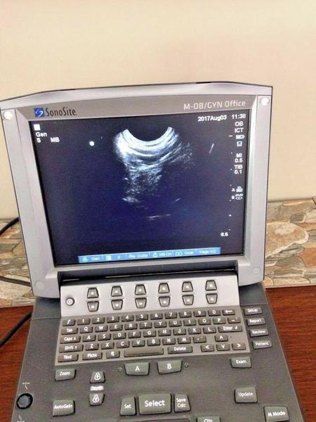 Sonosite ICT8-5 Intracavitary Probe