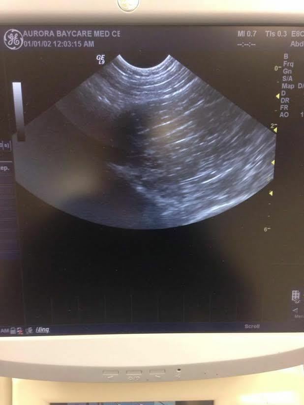 GE Logiq 9 Ultrasound Machine