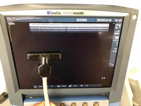 Sonosite SLT "T" Intraoperative Probe