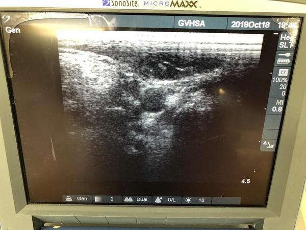 Sonosite SLT "T" Intraoperative Probe