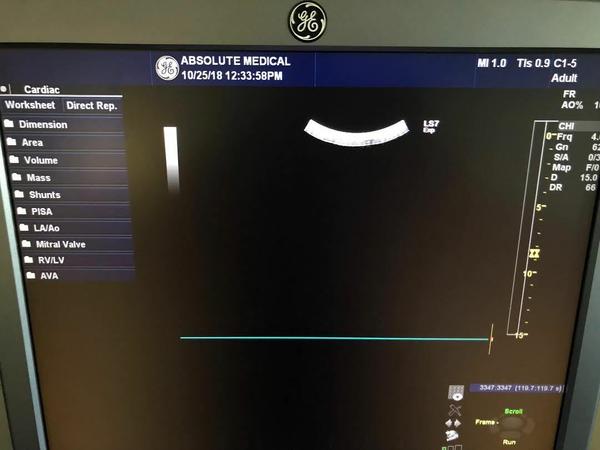 GE C1-5-D Curved Array Probe