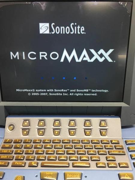 SonoSite MicroMaxx Portable Ultrasound Machine