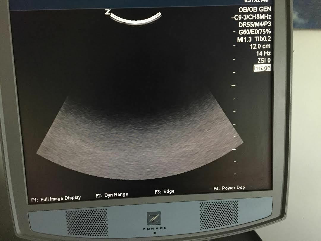 Zonare C9-3 Curved Array Ultrasound Probe