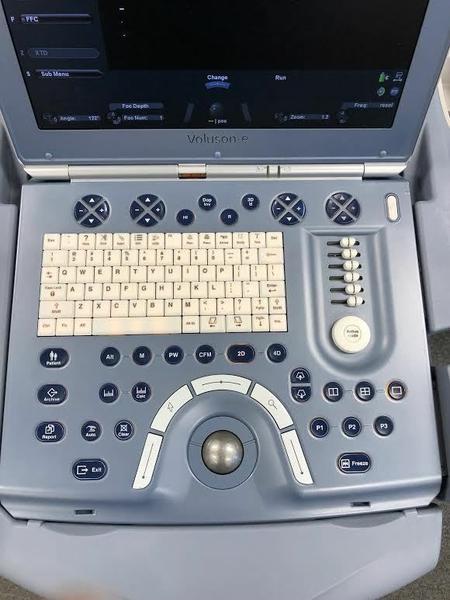 GE Voluson E Portable Ultrasound System