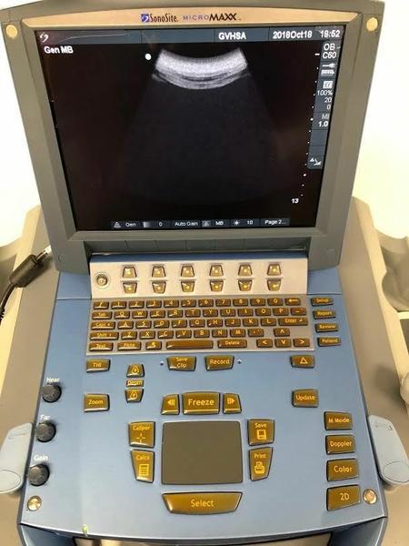 Sonosite C60E Curved Array Probe