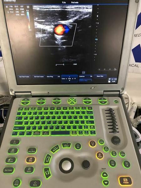 Mindray M5 Portable Ultrasound Machine