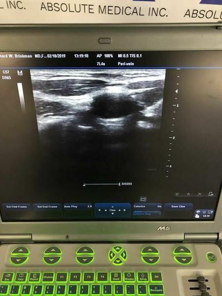 Mindray M5 Portable Ultrasound Machine