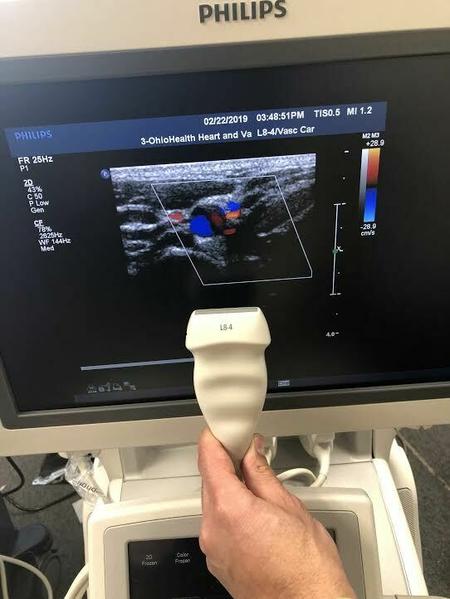 Philips L8-4 Linear Array Probe