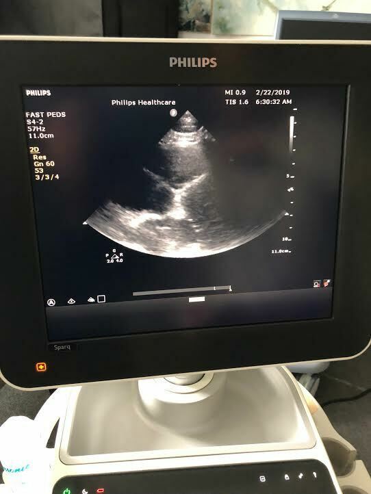 Philips S4-2 Sector Array Phased Array Cardiac Probe Transducer for Sparq