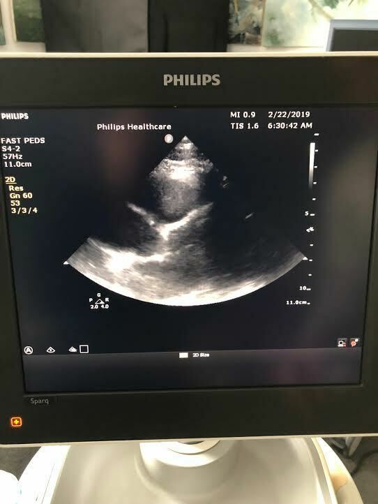 Philips S4-2 Sector Array Phased Array Cardiac Probe Transducer for Sparq