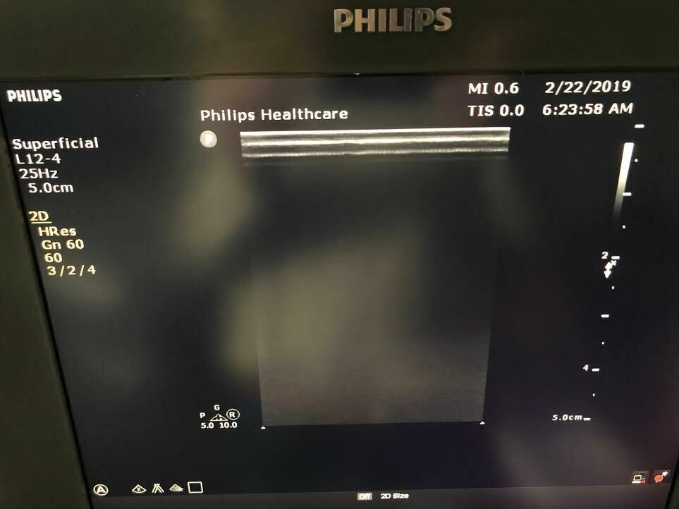 Philips L12-4 Linear Array Ultrasound Probe