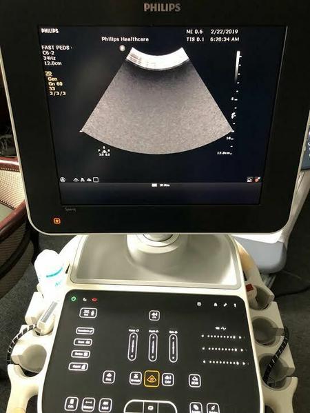 Philips  C6-2 Curved Array Probe