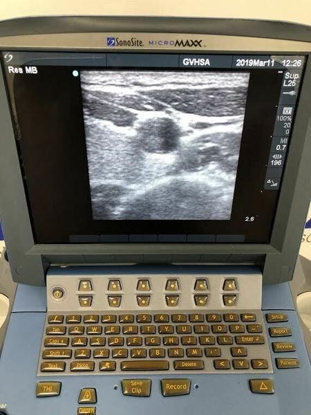 Sonosite L25e Linear Array Probe