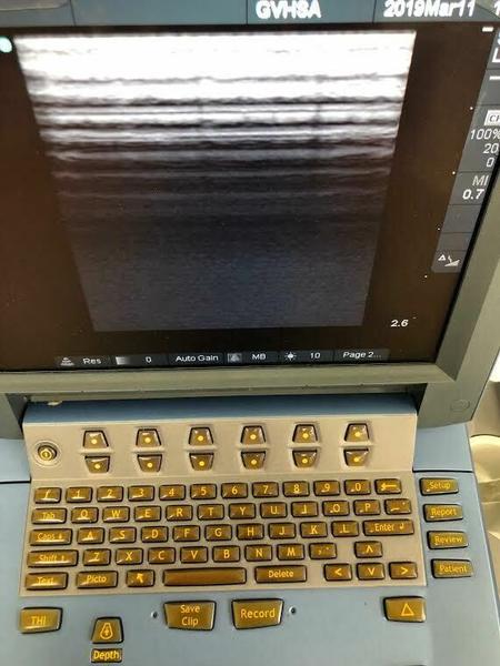 Sonosite L25e Linear Array Probe
