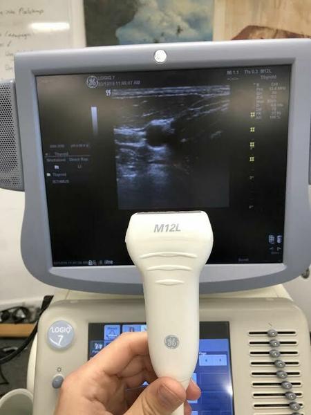 GE M12L Linear Array Probe