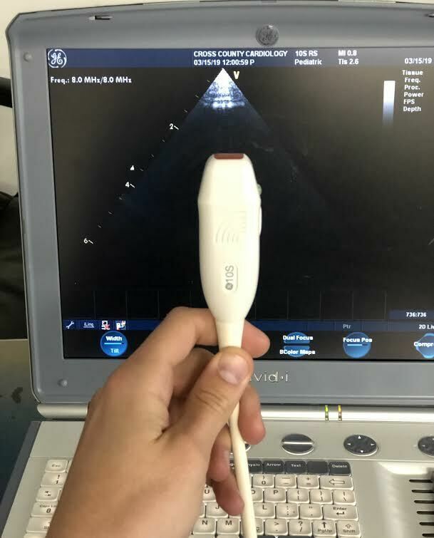GE 10S-RS Sector Array Probe